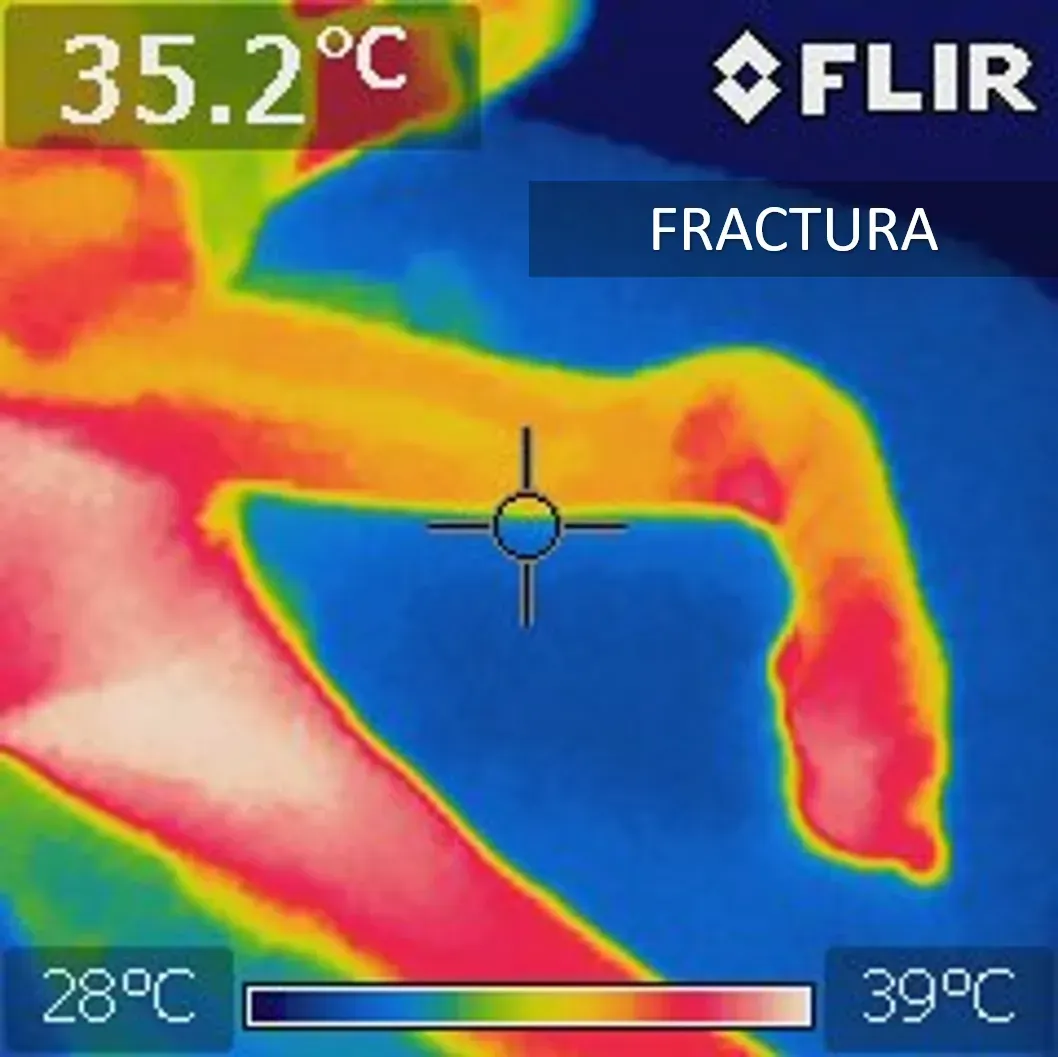 Endoscopios / Camara térmica